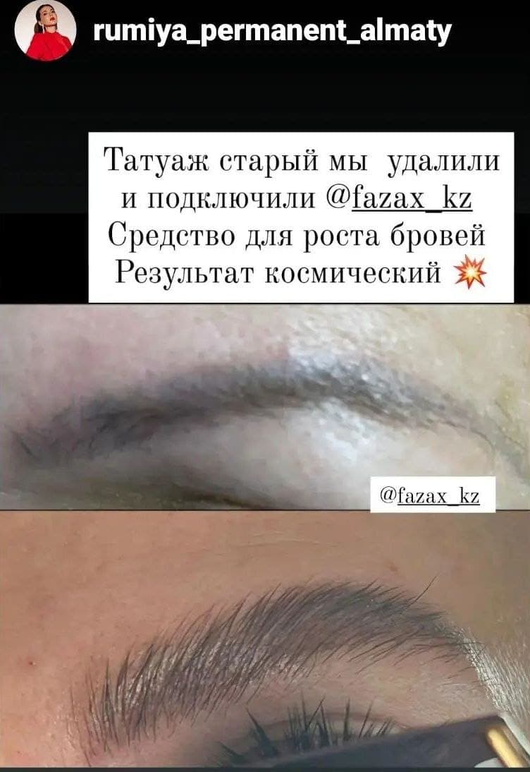Средство для стимуляции роста бровей Fazax (Depixil 17%). 20 мл. — фото 6