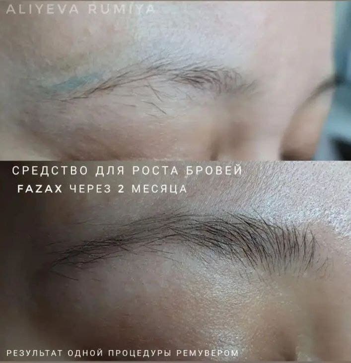 Средство для стимуляции роста бровей Fazax (Depixil 17%). 20 мл. — фото 9