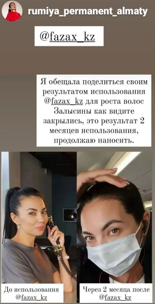 Средство для стимуляции роста волос Fazax (Depixil 15%). 8 мл. — фото 10