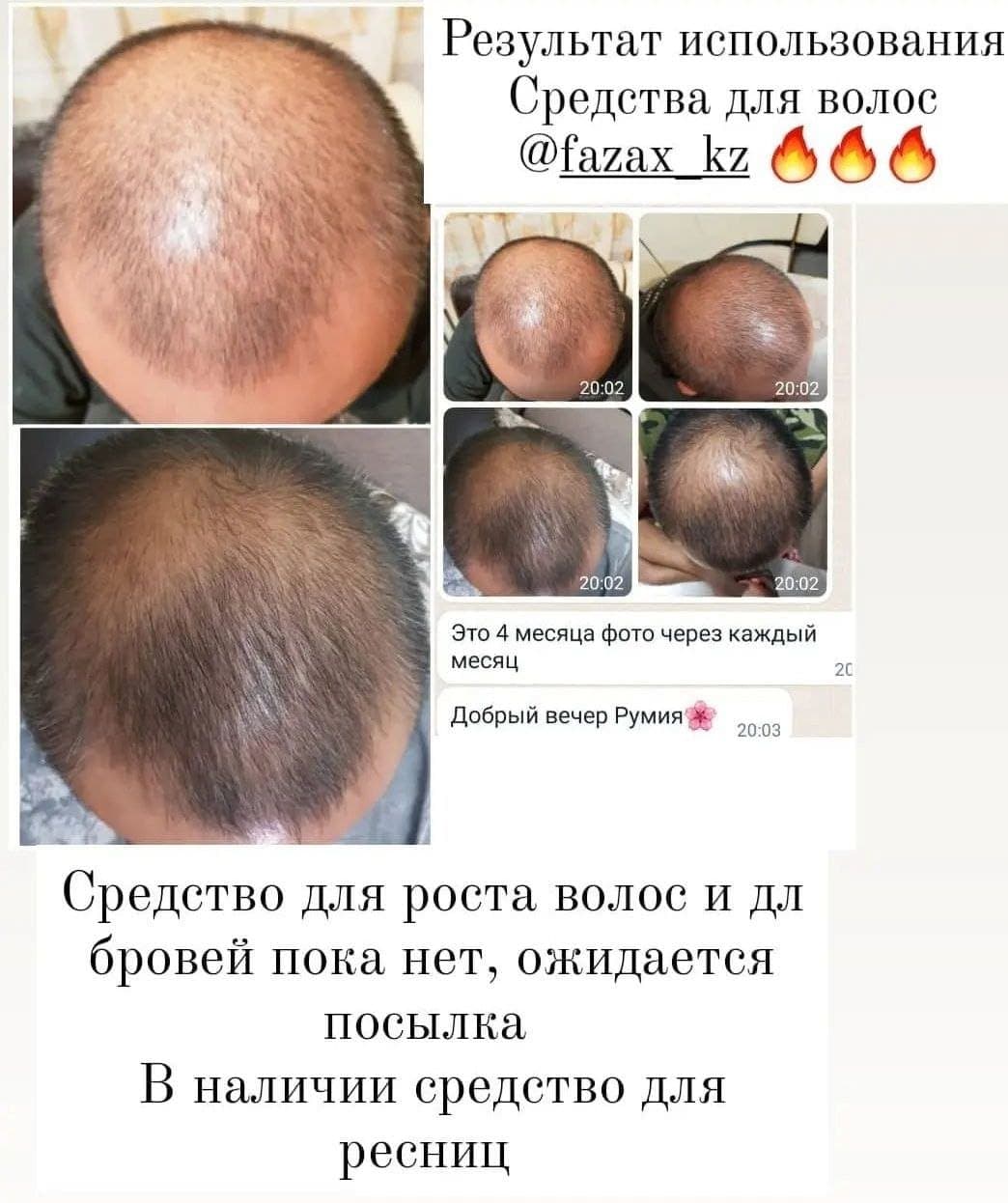 Средство для стимуляции роста волос Fazax (Depixil 15%). 8 мл. — фото 9